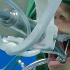 Actualite-dentaire-yomi-le-robot-poseur-d-implants-dentaire-service.jpg